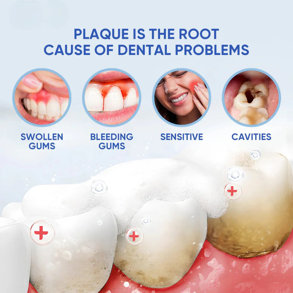 Radiant Smile Probiotic Toothpaste™